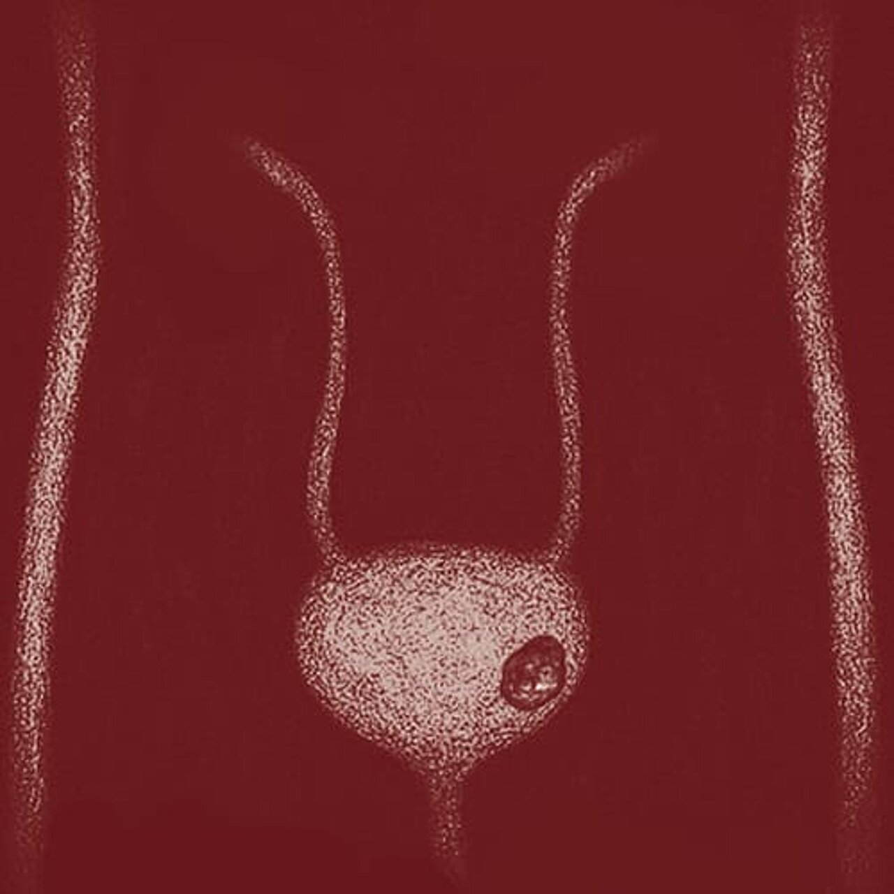 Grafik zum Thema Harnblasenkrebs