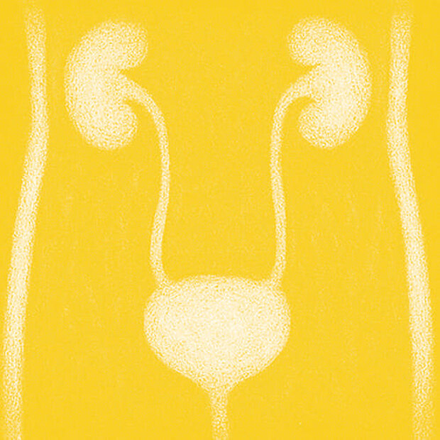 Grafik zum Thema Harnleiterenge