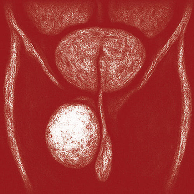Grafik zum Thema Hodenkrebs
