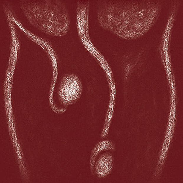 Grafik zum Thema Hodenhochstand