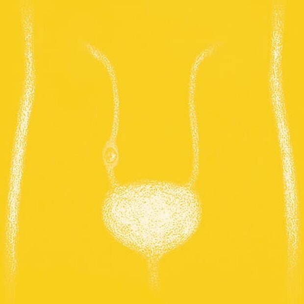 Grafik zum Thema Harnleiterstein