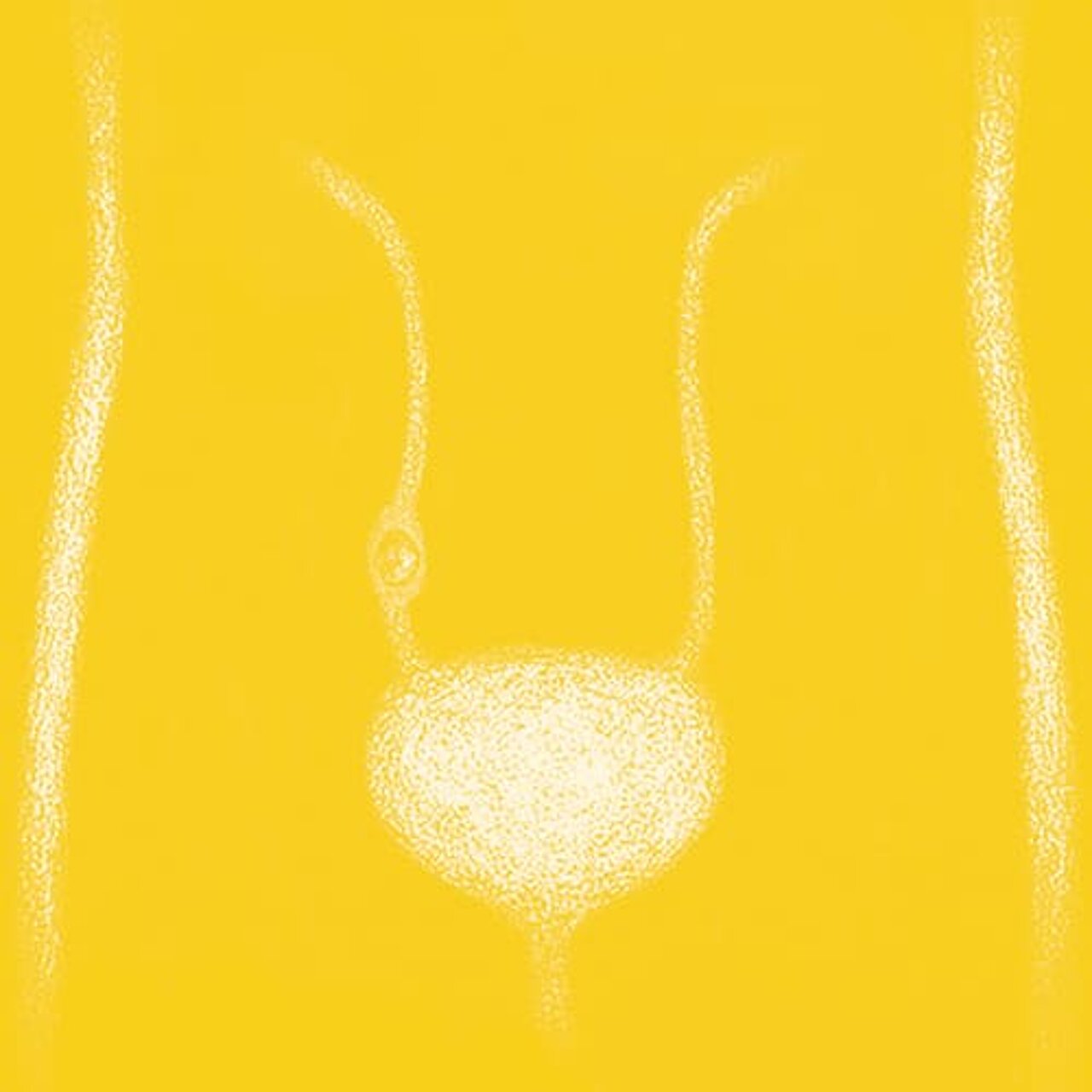 Grafik zum Thema Harnleiterstein