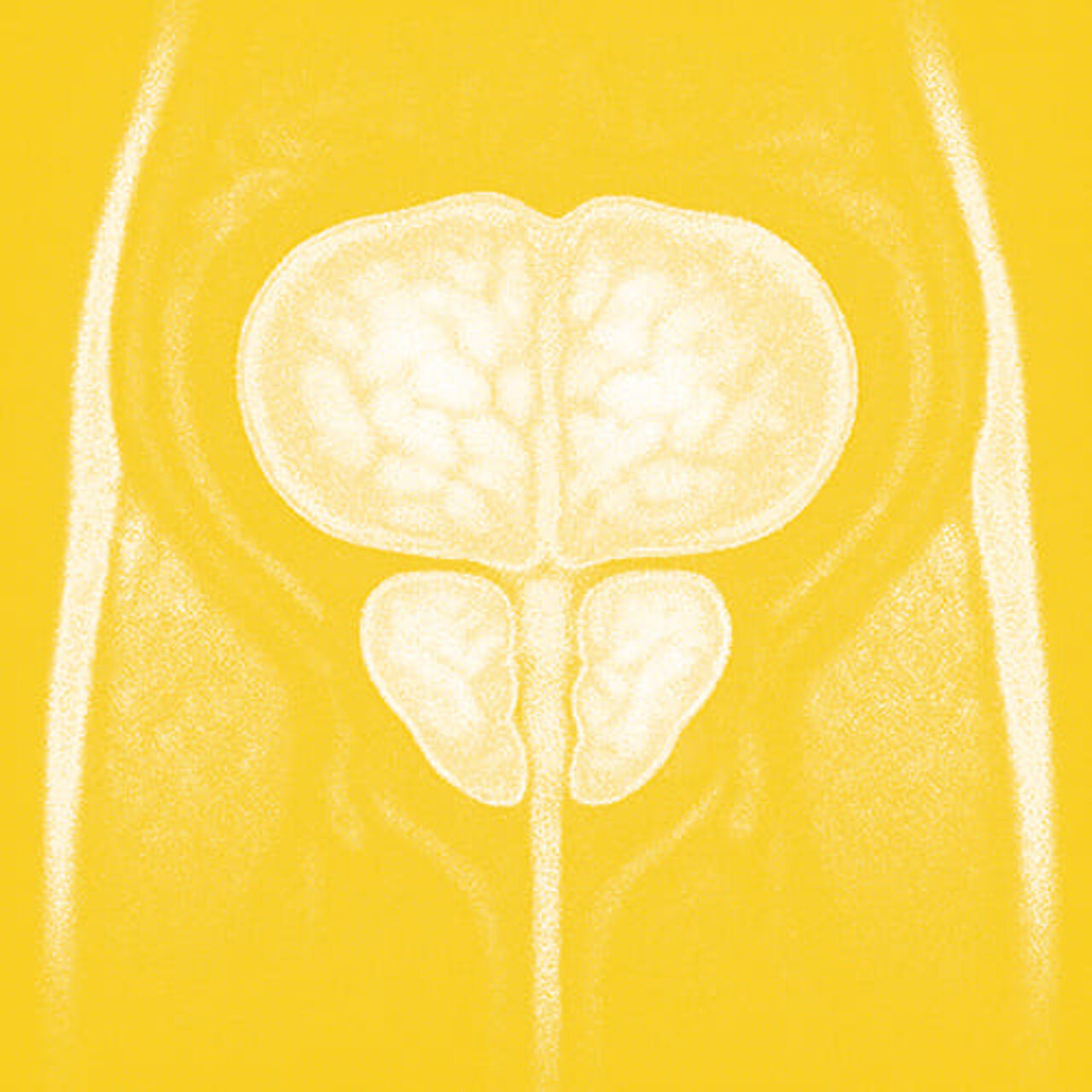 Grafik zum Thema Prostatavergrößerung