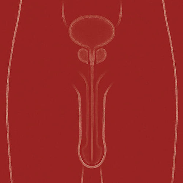 Grafik zum Thema Peniskarzinom