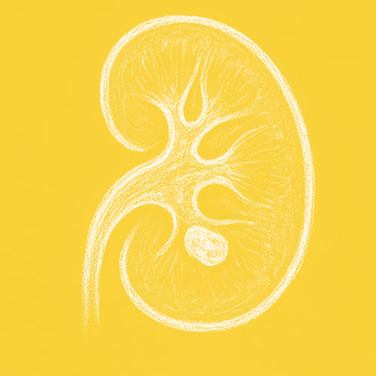 Grafik zum Thema Nierensteine